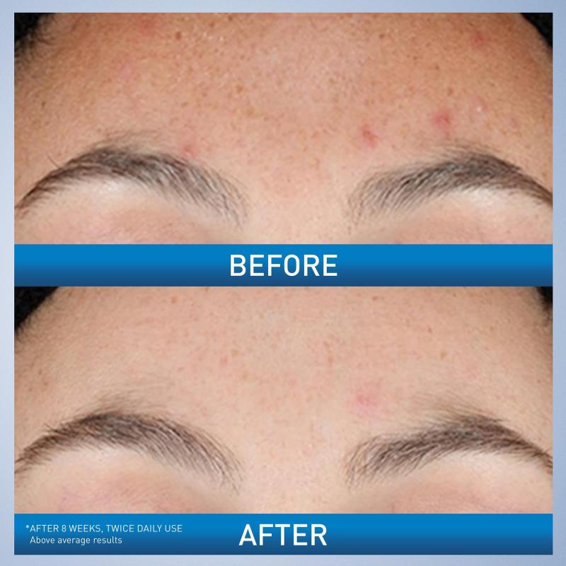 CeraVeResurfacing Retinol Serum 30 ml