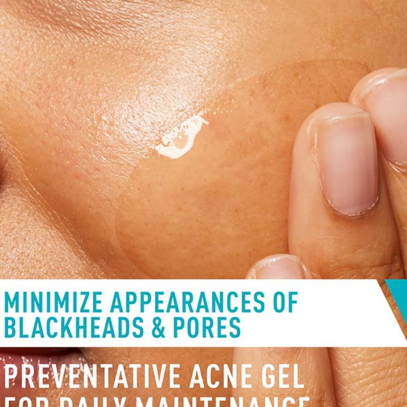 CeraVe Acne Control Gel,2%Salicylic Acid Treatment With Glycolic Acid + Lactic